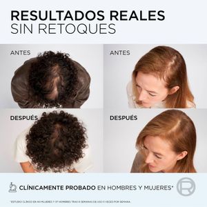 Sisena imatge del producte Xampú Anticaiguda Growth Booster de la marca ELVIVE