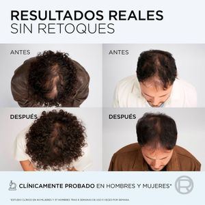 Setena imatge del producte Xampú Anticaiguda Growth Booster de la marca ELVIVE
