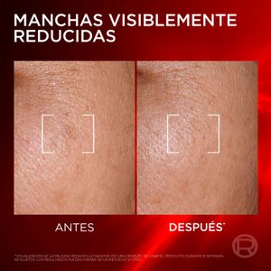 Quinta imatge del producte Triple Sèrum Antiedat Revitalift Laser de la marca L'OREAL