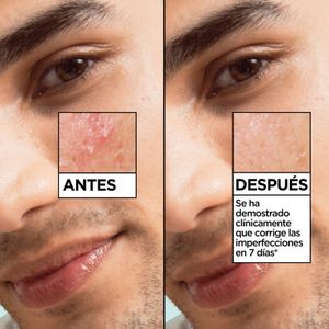 Sisena imatge del producte Sèrum Àcid Salicílic Antiimperfeccions de la marca GARNIER