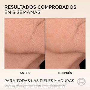 Sisena imatge del producte Sèrum Antiflacciditat Age Perfect de la marca L'OREAL